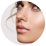rinoplastia